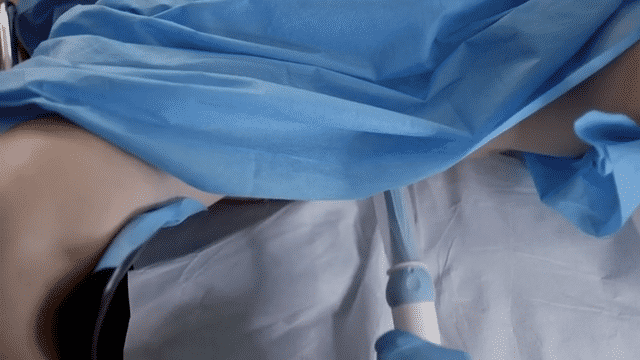 Viral Clip Bodyform: #wombstories